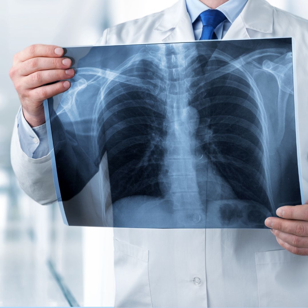 Thoracic Pathology